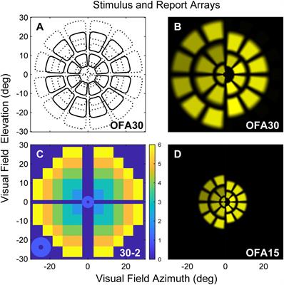 Discriminating early-stage diabetic retinopathy with subjective and objective perimetry
